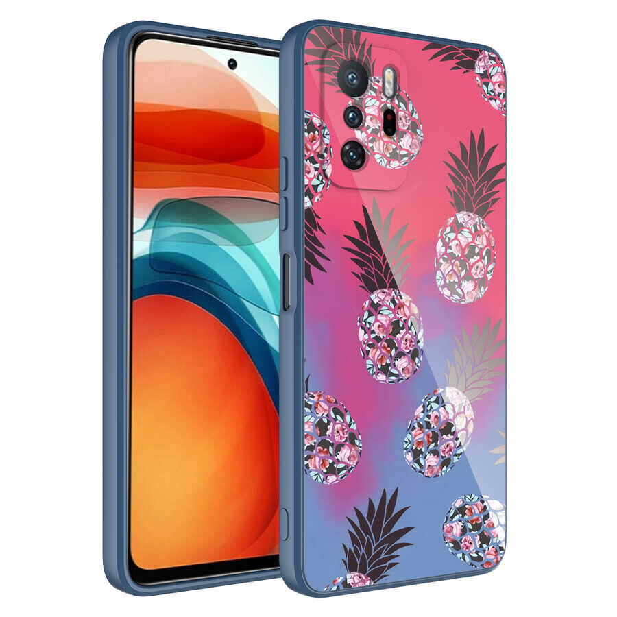 Xiaomi Redmi Note 10 Pro Kılıf Kamera Korumalı Desenli Sert Silikon Zore Epoksi Kapak - 1